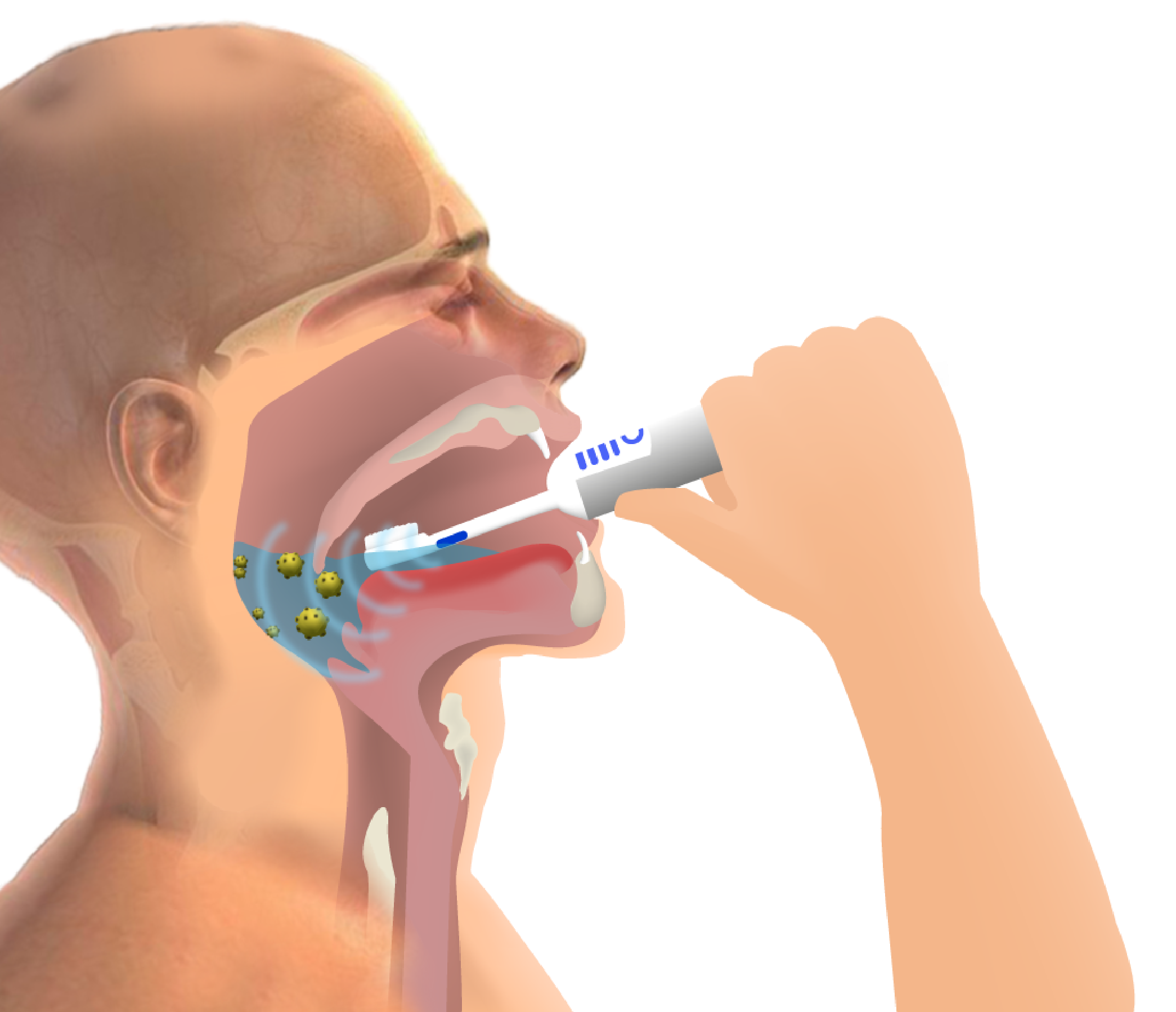 Ultrasound kills bacteria